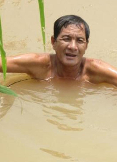 Kinh di ong chong nem hai cot vo xuong song vi me tin-Hinh-2