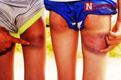 Thua Thien - Hue Mot thay giao bi to danh dap hoc sinh