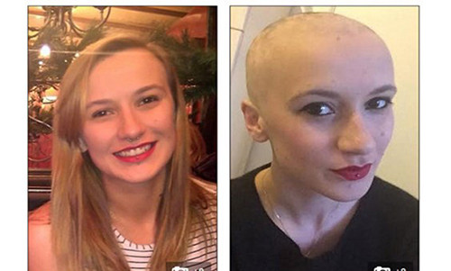 Co gai rung het toc vi qua cang thang