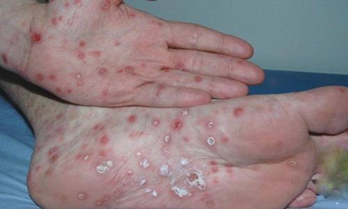 Me ngat xiu vi con lop 9 bi phan mac giang mai