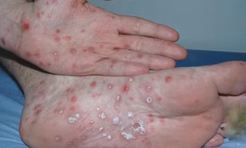 Me ngat xiu vi con lop 9 bi phan mac giang mai