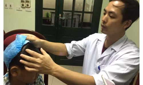 Phau thuat thanh cong benh nhan bi dong kinh con cuoi