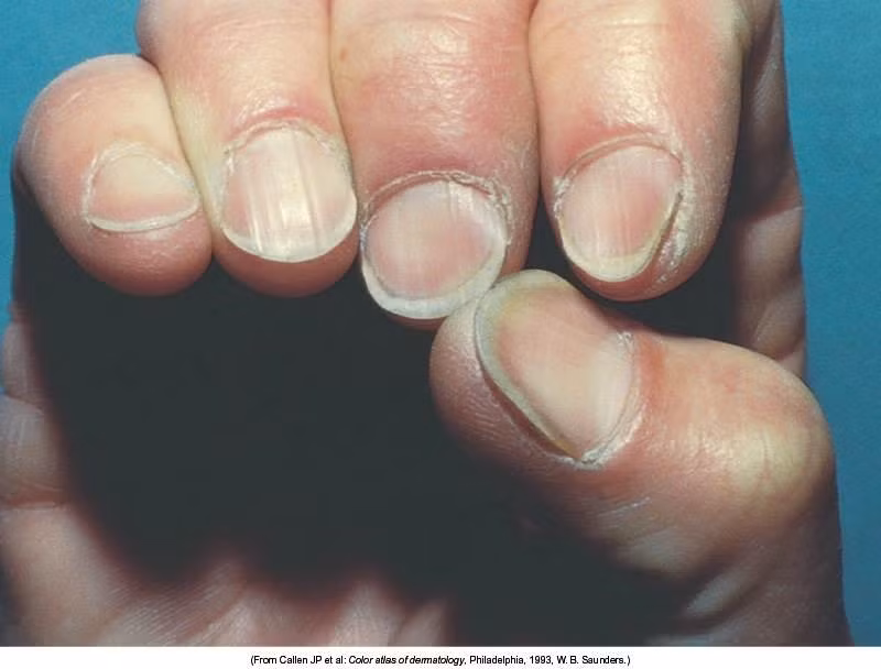 13 dau hieu benh tat ngo la dieu binh thuong-Hinh-2