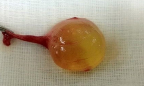 Ta hoa vi con trai bong dung co 3 tinh hoan