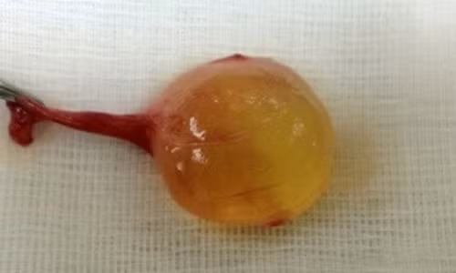 Ta hoa vi con trai bong dung co 3 tinh hoan