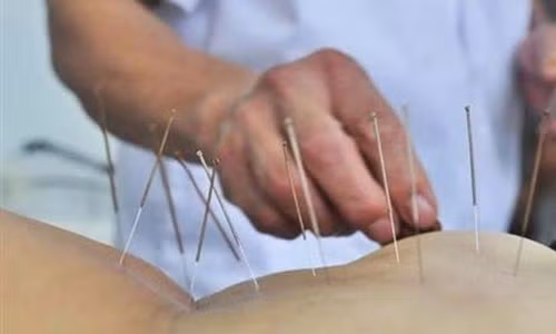 Sap bay dich vu cham cuu, bam huyet chui tai nha