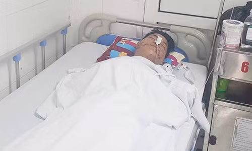 Dien vien xiec nat mat khi cho dau vao mieng ca sau