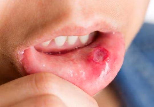 Uong nuoc nay nhiet mieng bao nhieu cung khoi