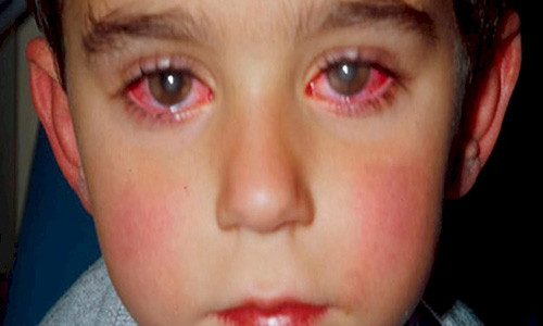 Nhung loai do choi co the khien tre bi mu vinh vien