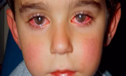 Nhung loai do choi co the khien tre bi mu vinh vien