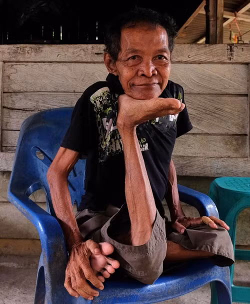 Độc lạ: Ông già U70 uốn dẻo chân tay như kẹo kéo - Hình 2 Doc la: Ong gia U70 uon deo chan tay nhu keo keo-Hinh-2