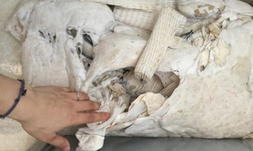 Ta hoa khi mo ruot goi ra giat thay toan rac ban