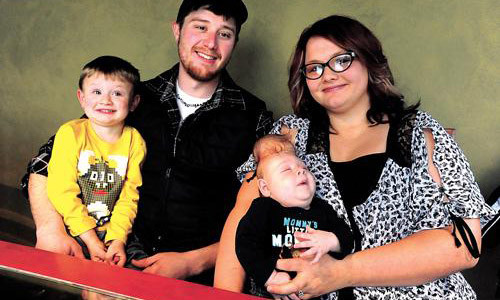 Một phần lớn não của em không được bao bọc bởi hộp sọ hở.