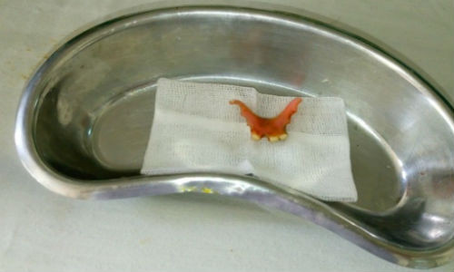 Hy huu rang gia roi xuong ruot gia dam thung dai trang