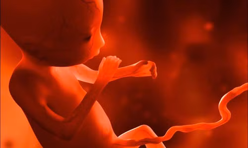 Cậu bé 4 tuổi được chẩn đoán khi sinh ra đã có một bào thai ở trong bụng gọi là hiện tượng thai trong thai..