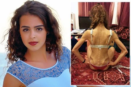 Dần dần, cô đã lấy lại được khẩu vị và không còn sợ khi đến bữa ăn. Hiện nay, không chỉ lấy lại được vóc dáng chuẩn như người mẫu, Margherita còn được biết đến là hot girl có thân hình gợi cảm.