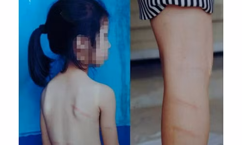 Nghe An: Hoc sinh lop 1 khong lam duoc bai to bi co giao danh