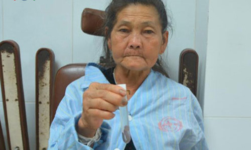 Khiep hon dia dai 7 cm song trong duong tho cu ba