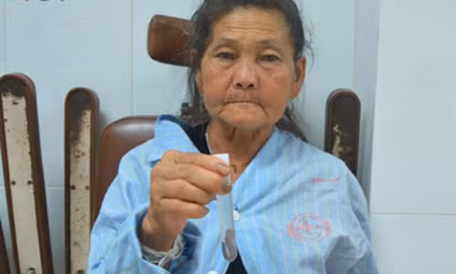 Khiep hon dia dai 7 cm song trong duong tho cu ba