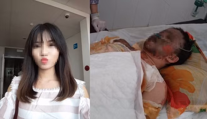 Hằng vừa tốt nghiệp đại học, chuẩn bị đi làm thì không may gặp nạn bất ngờ bị bỏng toàn thân, khuôn mặt biến dạng.