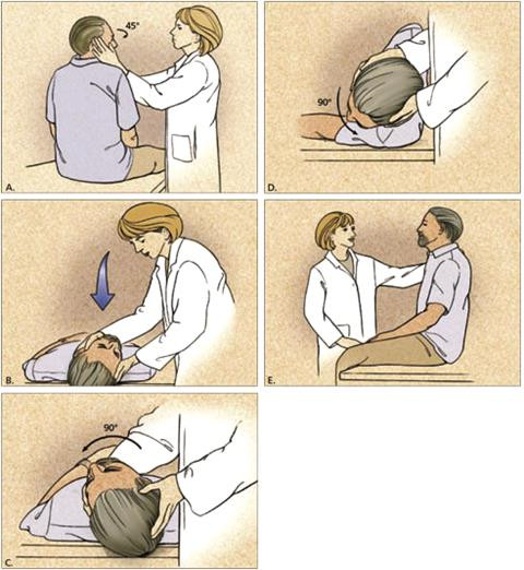 Tập hợp vận động đầu Epey manoeuvre cần được sự hỗ trợ của chuyên gia vật lý trị liệu.