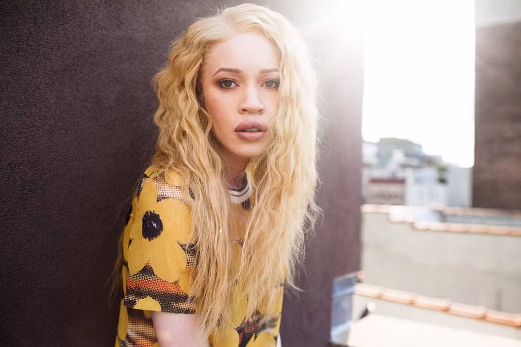 Diandra Forrest (28 tuổi, Mỹ) là người da đen nhưng lại mắc bệnh bạch tạng từ nhỏ. Vượt qua mọi mặc cảm và sự xa lánh của mọi người xung quanh, cô đã trở thành người mẫu chuyên nghiệp, nhanh chóng có cuộc sống sung túc. Hiện nay, Diandra Forrest ký hợp đồng với một trong những công ty người mẫu danh tiếng hàng đầu thế giới - Elite.