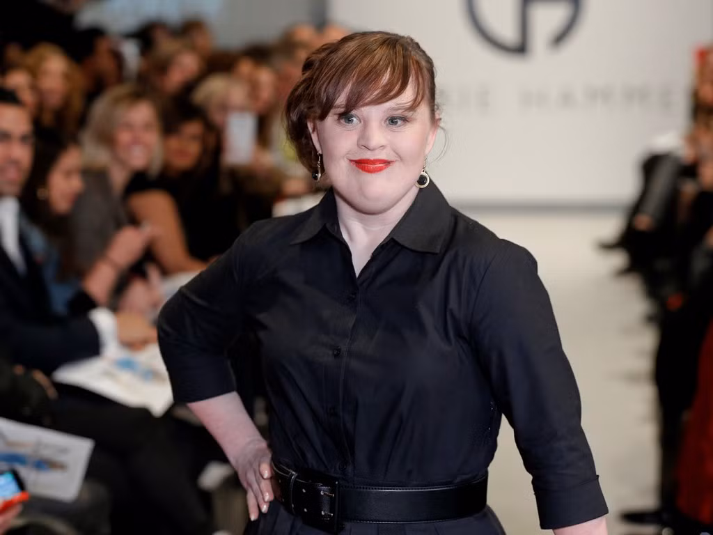Jamie Brewer (32 tuổi, Mỹ) là nữ diễn viên kiêm người mẫu mắc phải hội chứng down. Gạt bỏ mọi mặc cảm, cô vẫn hòa nhập cuộc sống và xây dựng được cho mình sự nghiệp đáng ngưỡng mộ.