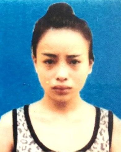 Vũ Hải Yến trước khi phẫu thuật thẩm mỹ