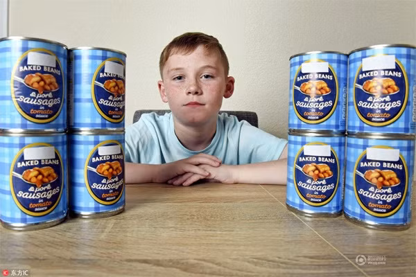 Tyler Hives (6 tuổi) đến từ Scotland chỉ ăn lạp xưởng và đậu đóng hộp.