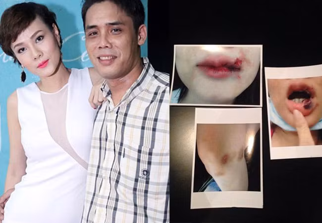 Tháng 9/2015, cựu mẫu Dương Yến Ngọc khẳng định bị chồng bạo hành nên đã đi đến quyết định ly hôn.