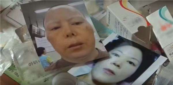 Cô Kim Bok Soon vì phẫu thuật thẩm mỹ hỏng đã phải sống chung với gương mặt dị dạng,mất việc, gặp bất đồng dẫn đến ly hôn và sống trong căn bệnh trầm cảm suốt nhiều năm. Tồi tệ hơn là Kim Bok Soon không thể nhắm mắt lại và mũi của cô không ngừng biến dạng.