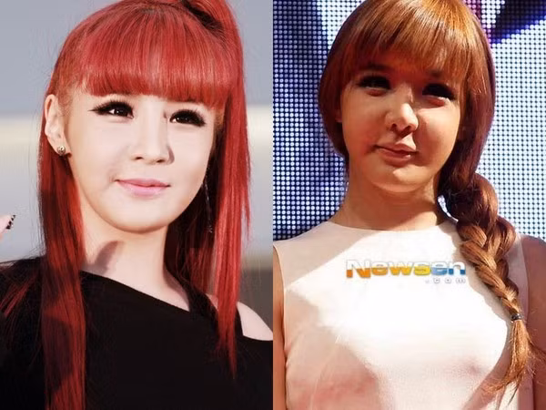 Do lạm dụng phẫu thuật thẩm mỹ, Park Bom đã nhanh chóng tự "huỷ hoại" bằng việc sử dụng nhiều botox, gây cứng, phù mặt cùng hệ quả trông thấy là nhìn cô già đi chục tuổi với gương mặt húp híp của mình.