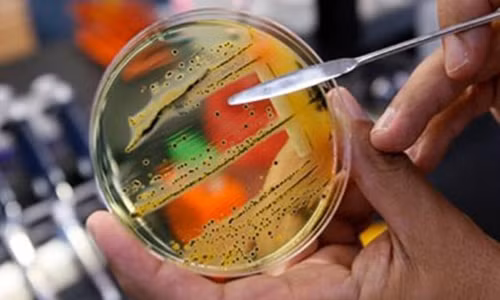 Cai chet cua be 17 ngay tuoi va noi lo cua toan cau