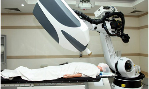 “Phau thuat” bang tia xa tri ung thu phoi