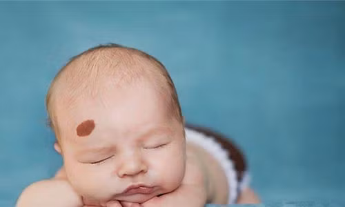 Vet bot la bang chung cua hien tuong luan hoi?