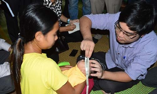 Trường hợp đầu tiên mắc hội chứng đầu nhỏ do virus Zika tại Việt Nam. Ảnh: ĐD