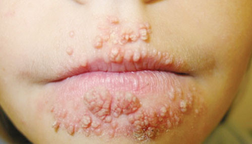 Nguy hai dang so khi cap doi ‘sinh’ doi gio ‘yeu bang mieng’-Hinh-2