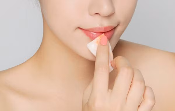 9 cach ho bien moi tham thanh moi hong-Hinh-3