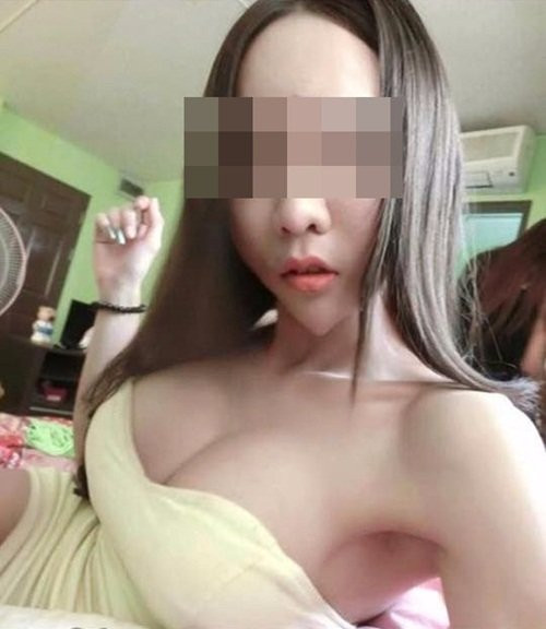 Sau cuộc phẫu thuật, cô nàng sở hữu chiếc cằm chuẩn V-line, nhọn hoắt, dị biệt như ý muốn. Ngay lập tức, cô gái trở nên nổi tiếng với chiếc cằm chẳng giống người. Một cư dân mạng Thái Lan đăng tải lại hình ảnh của cô gái này và khiến nhiều người choáng váng.