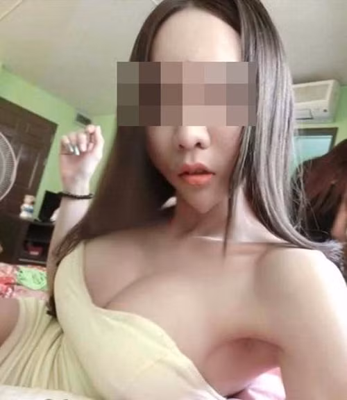 Sau cuộc phẫu thuật, cô nàng sở hữu chiếc cằm chuẩn V-line, nhọn hoắt, dị biệt như ý muốn. Ngay lập tức, cô gái trở nên nổi tiếng với chiếc cằm chẳng giống người. Một cư dân mạng Thái Lan đăng tải lại hình ảnh của cô gái này và khiến nhiều người choáng váng.