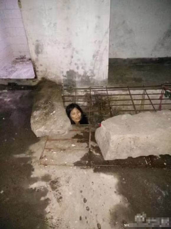 Điều trị trong một thời gian bệnh của cô có chuyển biến tốt nên đưa về nhà điều trị cho đỡ tốn kém. Nhưng không lâu sau bệnh lại tái phát, cô phá hỏng 2 chiếc ô tô của người đi đường, đập vỡ kính nhà hàng xóm và gây ra nhiều hành vi làm loạn khác…Vì vậy, nhằm đảm bảo an toàn cho những người xung quanh, bố đẻ của cô Bành đã nhốt con gái vào chiếc lồng sắt dưới lòng đất để tránh gây ra tai họa.