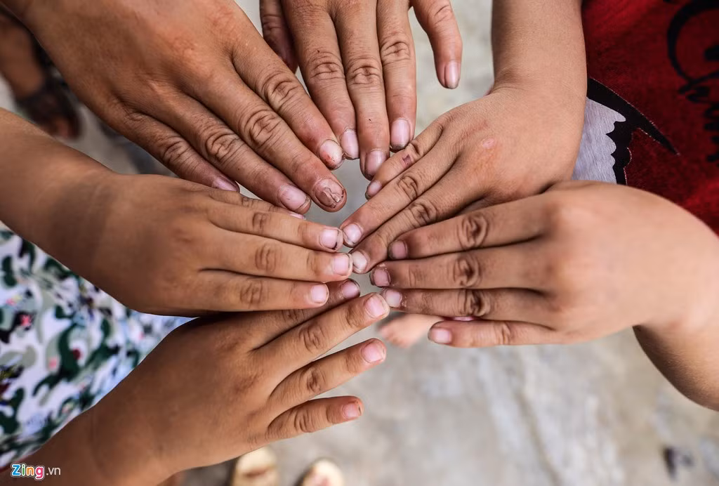 Người mẹ quanh năm quần quật, không còn thời gian cắt tỉa móng tay cho đàn con.