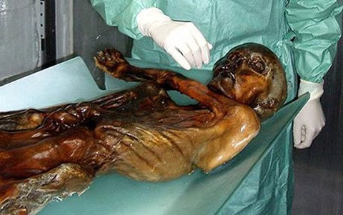 Nhung loi nguyen xuyen the ky xung quanh xac uop co-Hinh-3