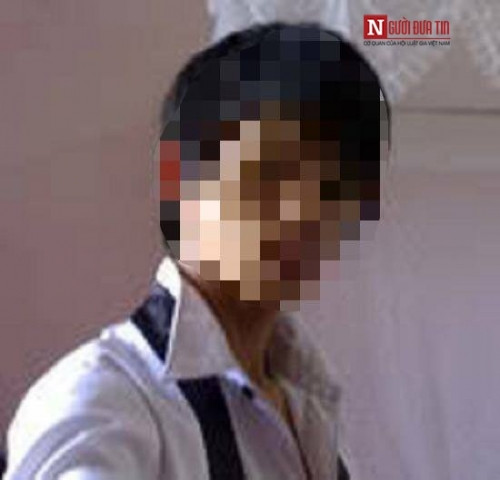 Cay dang phan trai bao thung truc trang, dinh AIDS vi quan he dong tinh