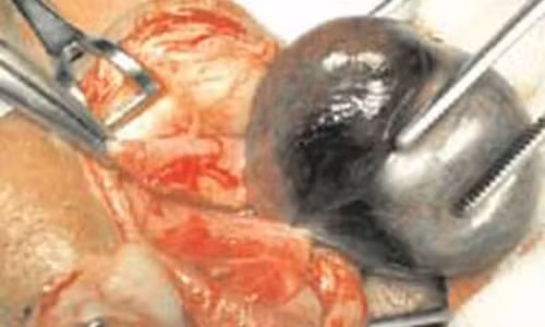 Nghịch dại hạt "ngọc", bé trai biến thành "thái giám" Nghich dai hat