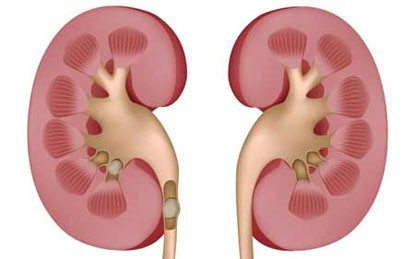 Dù rất tốt cho sức khỏe nhưng theo lương y Bùi Hồng Minh rau mùng tơi lại không tốt với một số người đặc biệt là những người bị sỏi thận, bị bệnh guot. Vì trong rau mùng tới chứa lượng axit oxalic, purin cao nên ăn nhiều rau mồng tơi chuyển hóa thành axit uric, sẽ tăng nồng độ canxi oxalate trong nước tiểu, tích tụ trong cơ thể dễ gây bệnh gout, sỏi thận. 