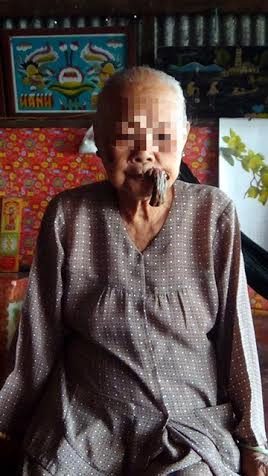 Bà Năm cho biết dòng họ, nội ngoại mình chưa có ai bệnh kỳ lạ như vậy.