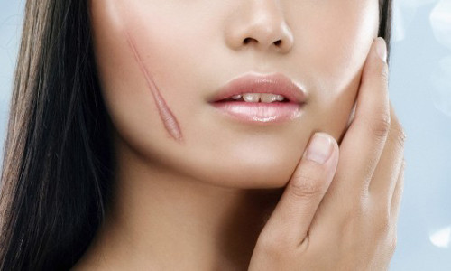 Vi tri vet seo xui xeo khien chu nhan gap hoa suot doi