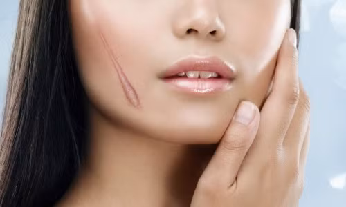 Vi tri vet seo xui xeo khien chu nhan gap hoa suot doi