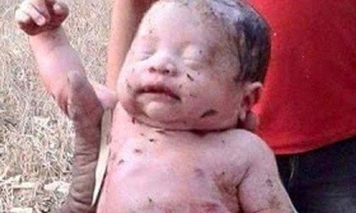 Than ky su song sot em be bi dam, chon song